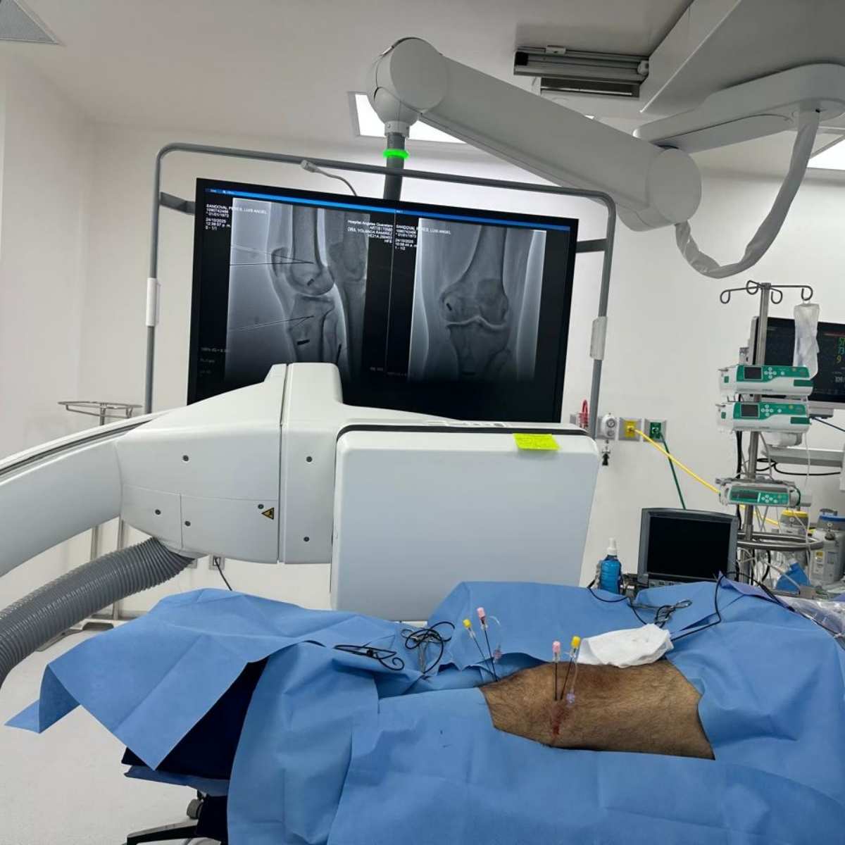 tratamiento-para-dolor-de-rodilla-yolanda-ramirez-a
