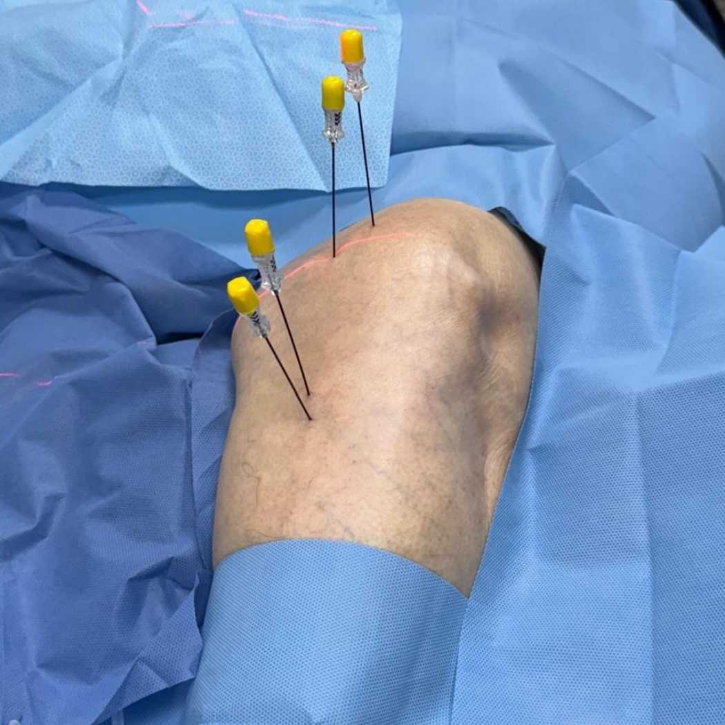 tratamiento-para-dolor-de-rodilla-yolanda-ramirez-a
