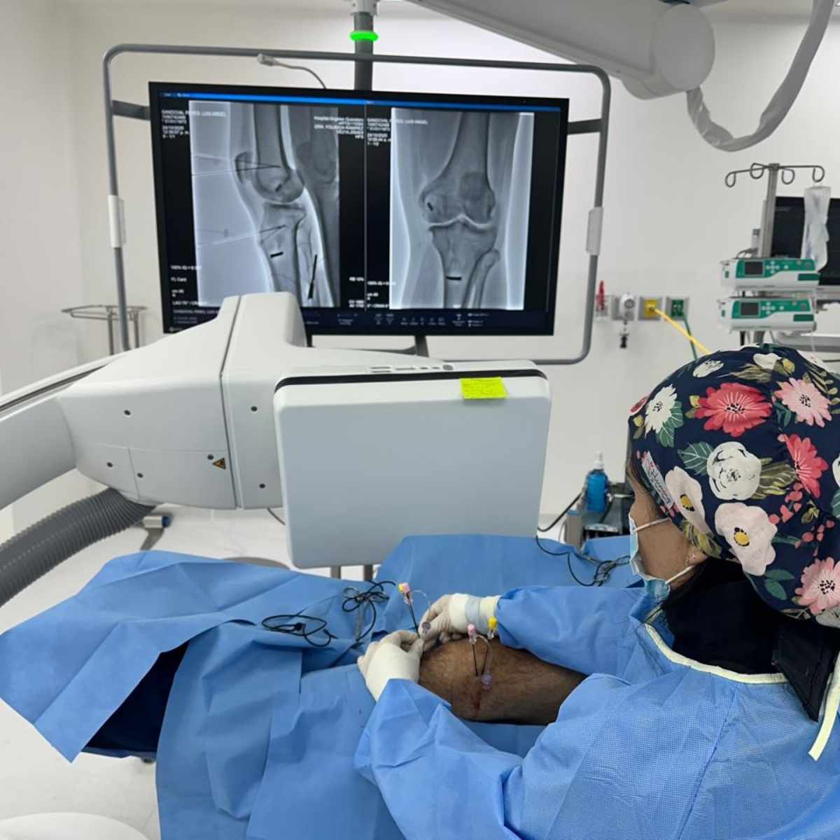 tratamiento-para-dolor-de-rodilla-yolanda-ramirez-a